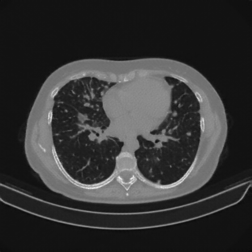 Generated VENOUS CT scan (A→B translation)
