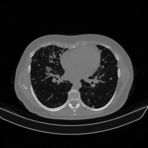 Original NATIVE CT scan (input)