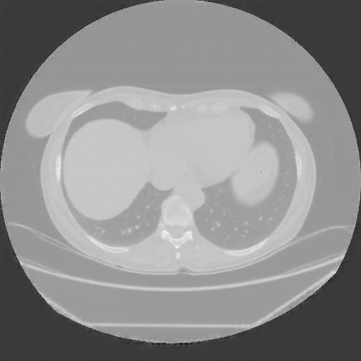 Generated VENOUS CT scan (A→B translation)