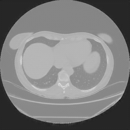 Reconstructed NATIVE CT scan (cycle consistency)