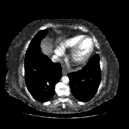 Generated VENOUS CT scan (A→B translation)