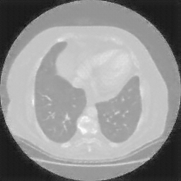 Generated VENOUS CT scan (A→B translation)