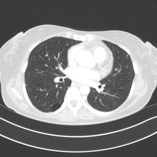 Original VENOUS CT scan
