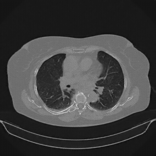 Generated VENOUS CT scan (A→B translation)