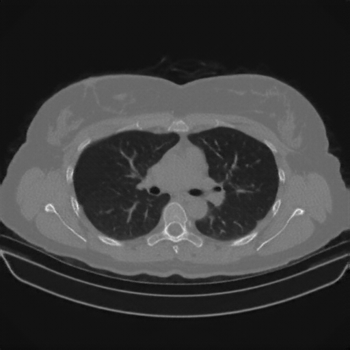 Generated VENOUS CT scan (A→B translation)