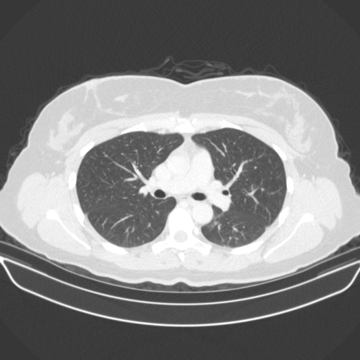 Original VENOUS CT scan