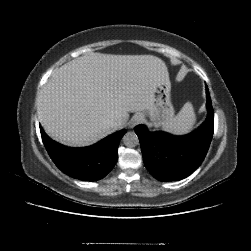 Generated VENOUS CT scan (A→B translation)