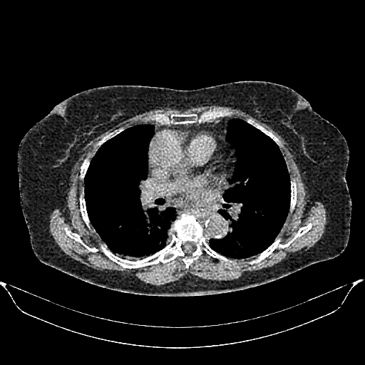 Generated VENOUS CT scan (A→B translation)