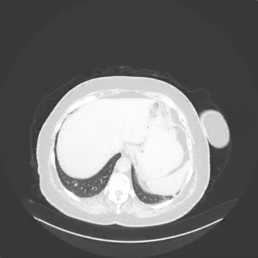 Generated VENOUS CT scan (A→B translation)