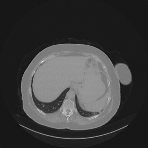 Generated VENOUS CT scan (A→B translation)
