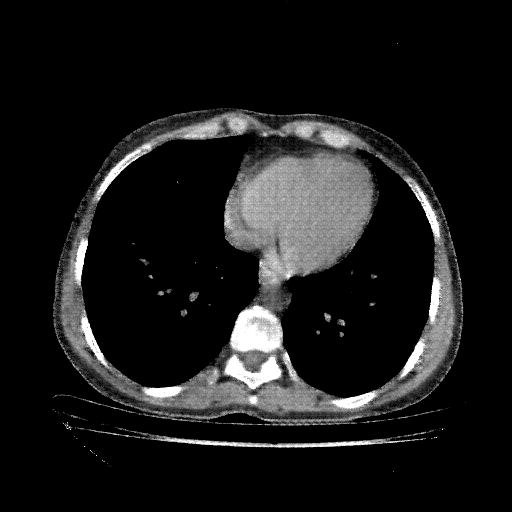 Generated VENOUS CT scan (A→B translation)