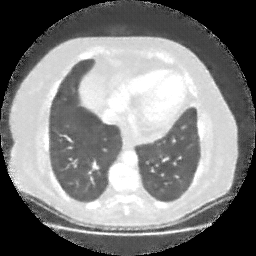 Generated VENOUS CT scan (A→B translation)