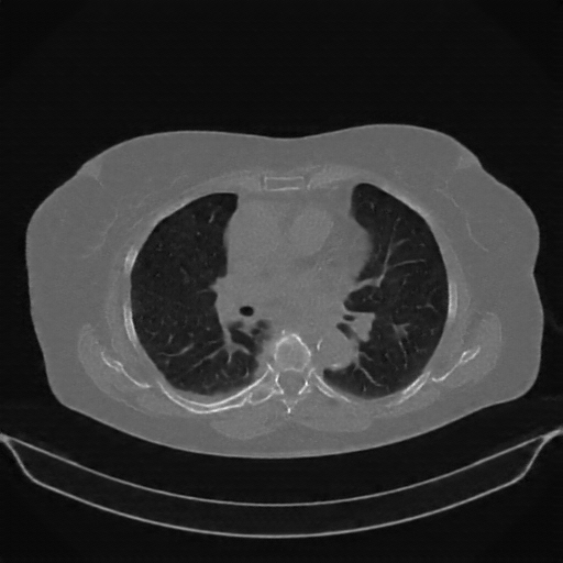 Reconstructed NATIVE CT scan (cycle consistency)
