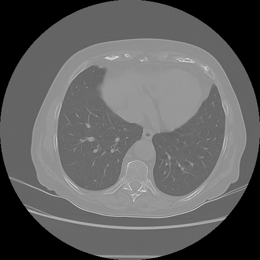 Original NATIVE CT scan (input)
