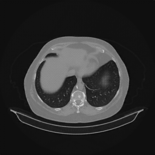 Generated VENOUS CT scan (A→B translation)