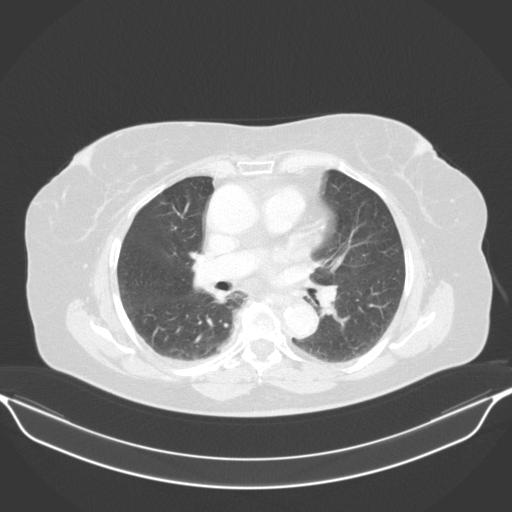 Original VENOUS CT scan