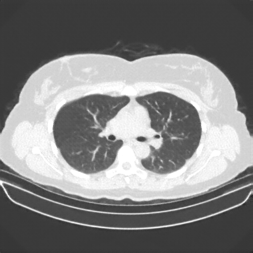 Generated VENOUS CT scan (A→B translation)
