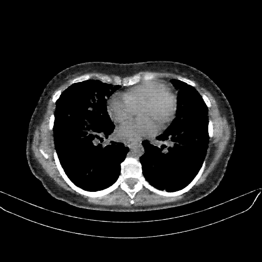 Generated VENOUS CT scan (A→B translation)