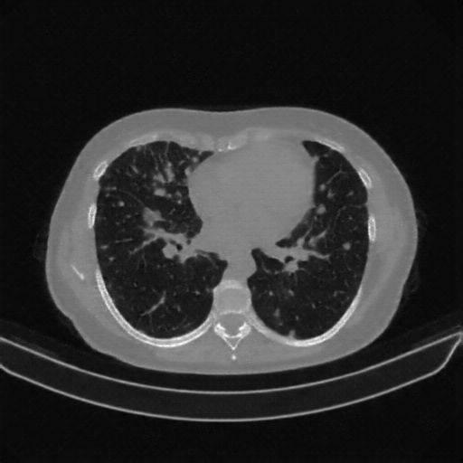 Generated VENOUS CT scan (A→B translation)