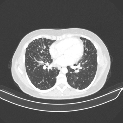 Original VENOUS CT scan