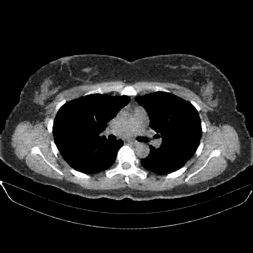 Generated VENOUS CT scan (A→B translation)