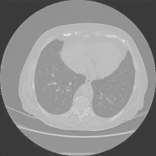Generated VENOUS CT scan (A→B translation)