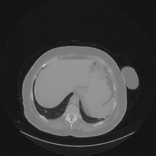 Generated VENOUS CT scan (A→B translation)