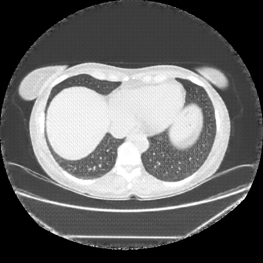 Generated VENOUS CT scan (A→B translation)