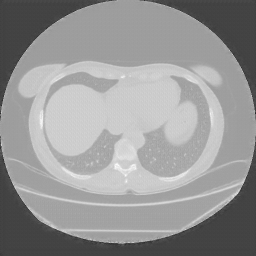 Generated VENOUS CT scan (A→B translation)