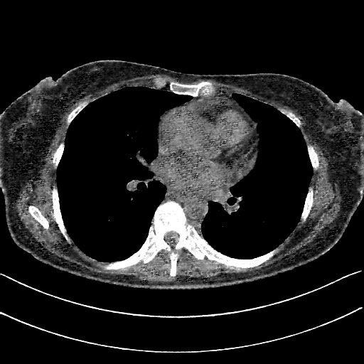 Generated VENOUS CT scan (A→B translation)