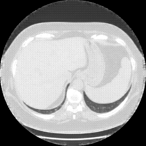 Generated VENOUS CT scan (A→B translation)