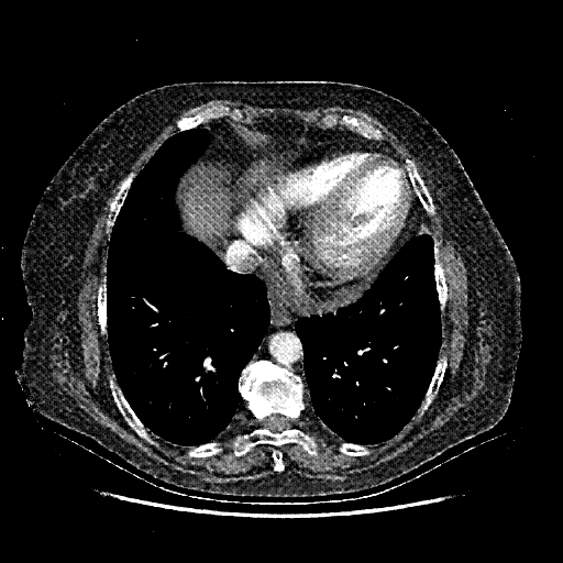 Generated VENOUS CT scan (A→B translation)