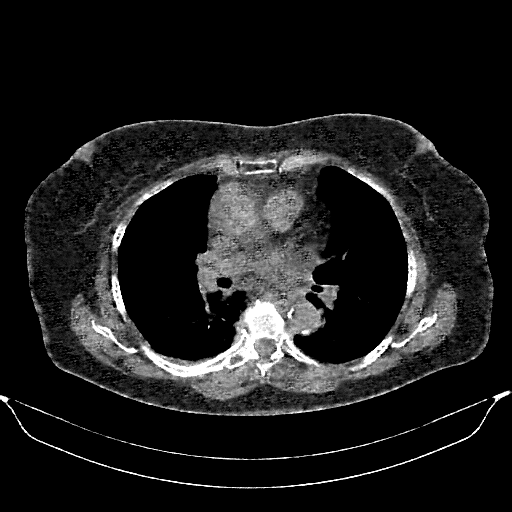 Generated VENOUS CT scan (A→B translation)