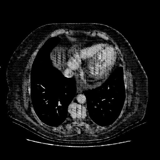 Generated VENOUS CT scan (A→B translation)