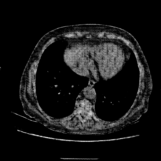 Generated VENOUS CT scan (A→B translation)