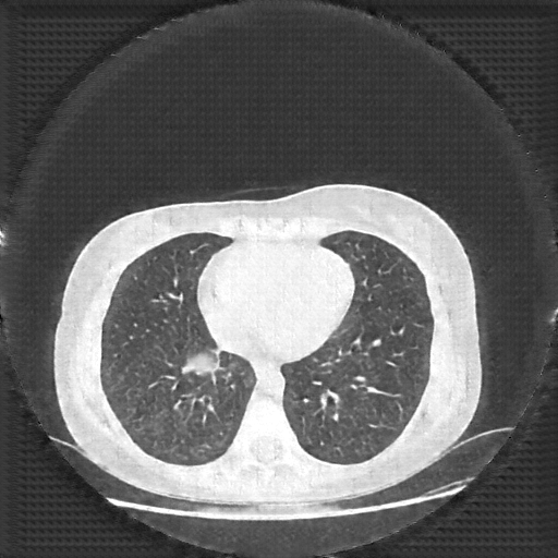 Generated VENOUS CT scan (A→B translation)