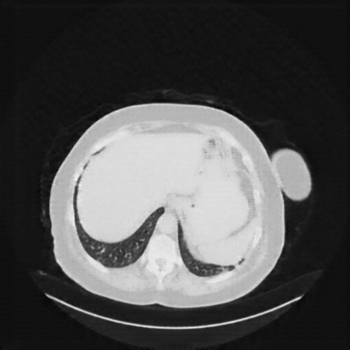 Generated VENOUS CT scan (A→B translation)