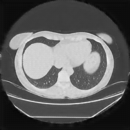 Reconstructed NATIVE CT scan (cycle consistency)