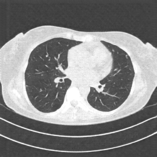 Generated VENOUS CT scan (A→B translation)