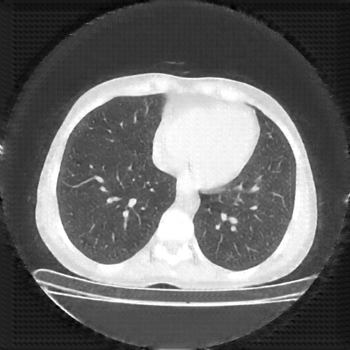 Generated VENOUS CT scan (A→B translation)