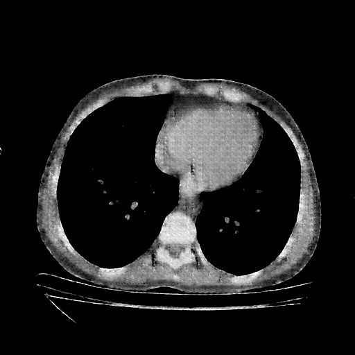 Generated VENOUS CT scan (A→B translation)