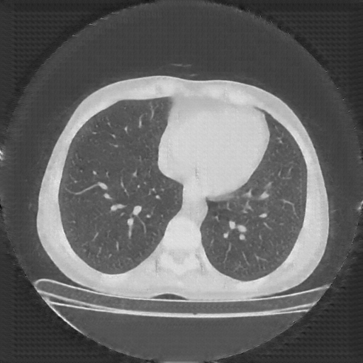 Generated VENOUS CT scan (A→B translation)