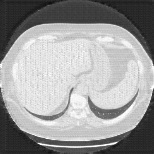 Generated VENOUS CT scan (A→B translation)
