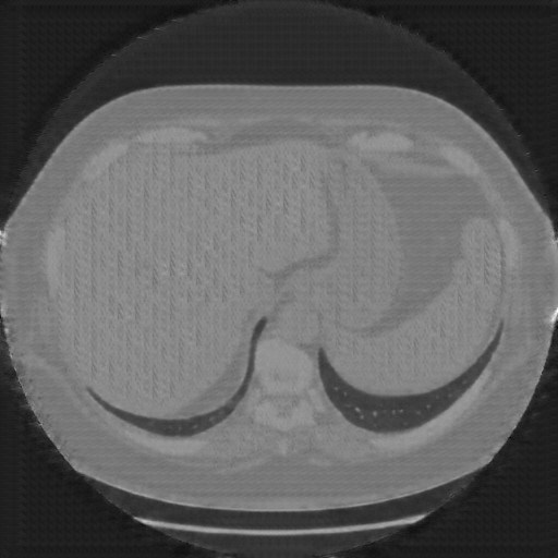 Generated VENOUS CT scan (A→B translation)