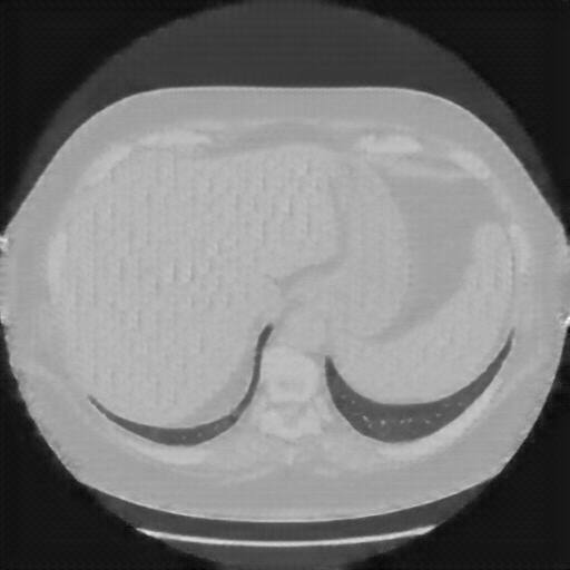 Reconstructed NATIVE CT scan (cycle consistency)