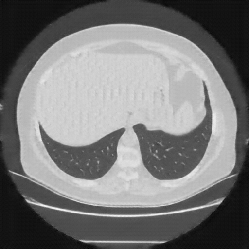 Reconstructed NATIVE CT scan (cycle consistency)