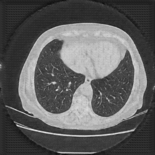Generated VENOUS CT scan (A→B translation)