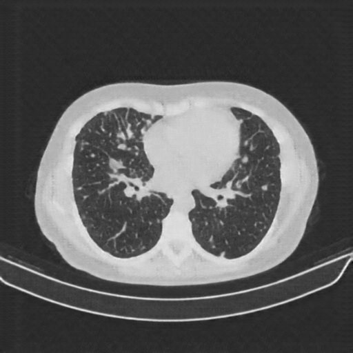 Generated VENOUS CT scan (A→B translation)
