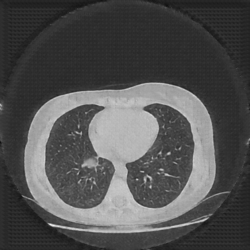 Generated VENOUS CT scan (A→B translation)