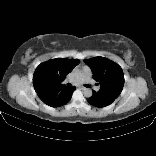 Generated VENOUS CT scan (A→B translation)